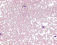 WRIGHT'S EOSIN METHYLENE BLUE FOR MICROS